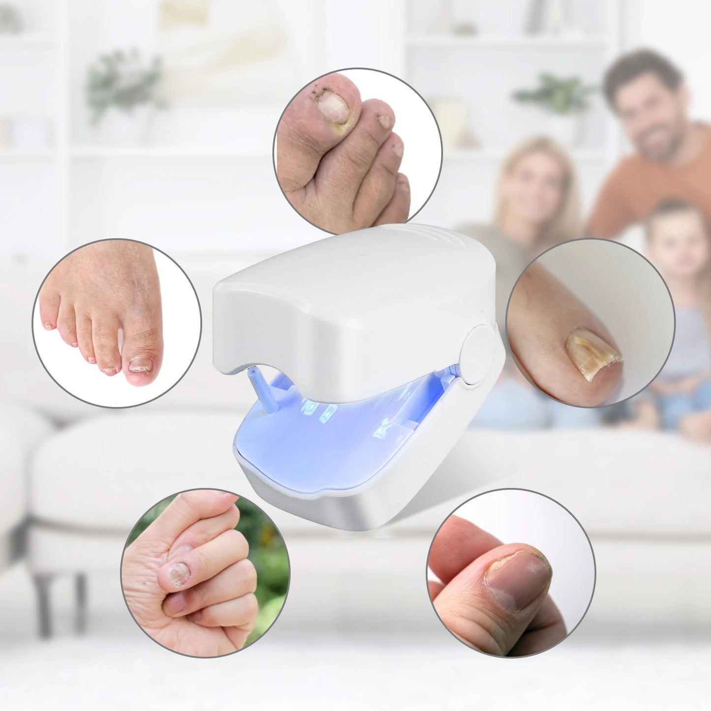 Infrared Nail Fungus Cleaning Device