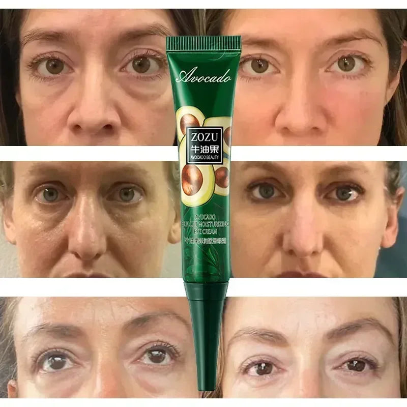 Wrinkle Removal Eye Cream