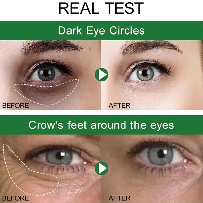 Wrinkle Removal Eye Cream