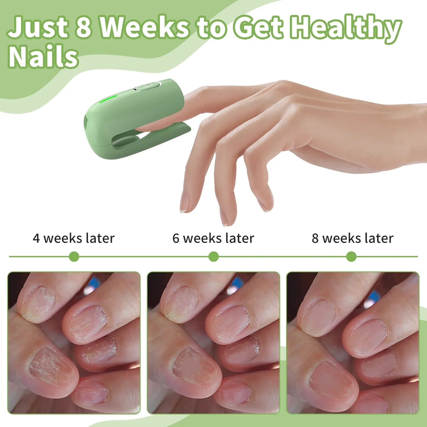Nail Phototherapy Device