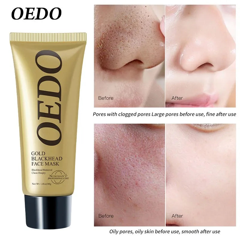 Blackhead Removing Mask