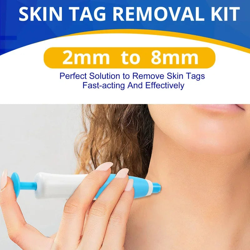 Skin Tag Remover Kit