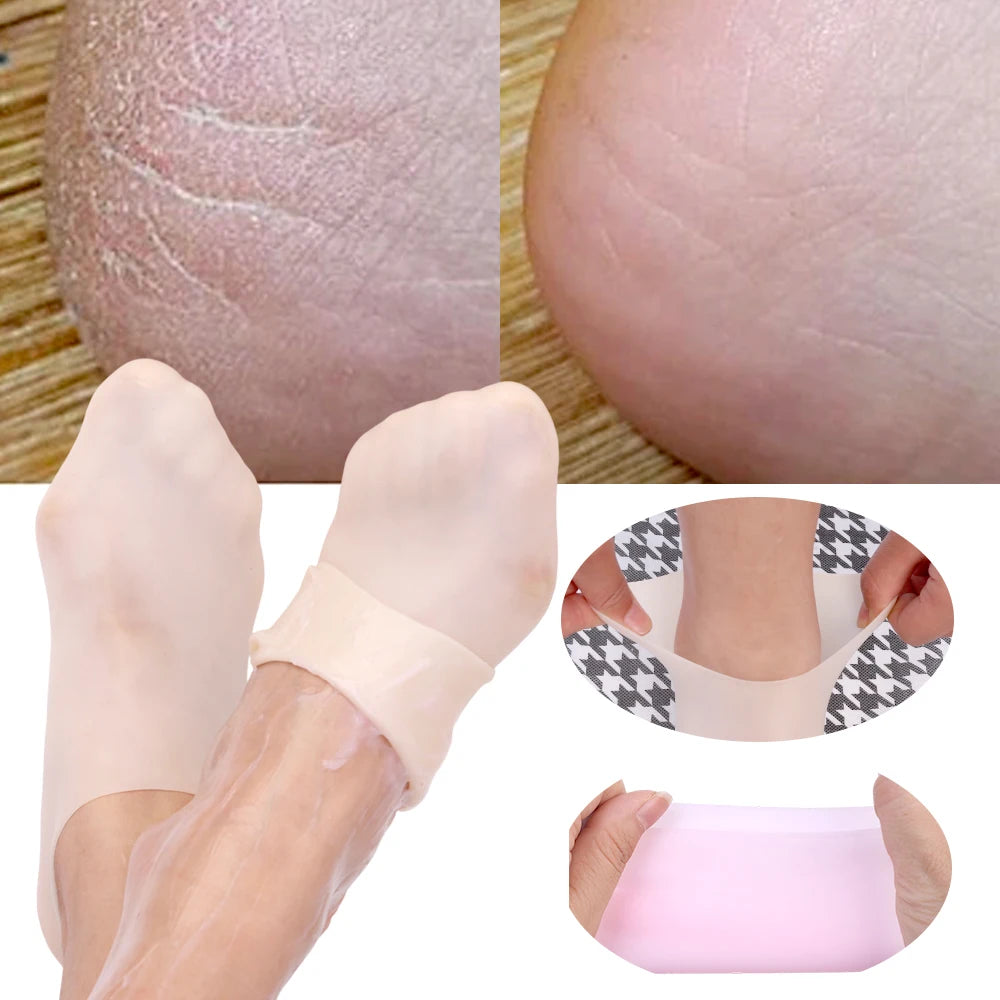 Silicone Moisturizing Foot Socks