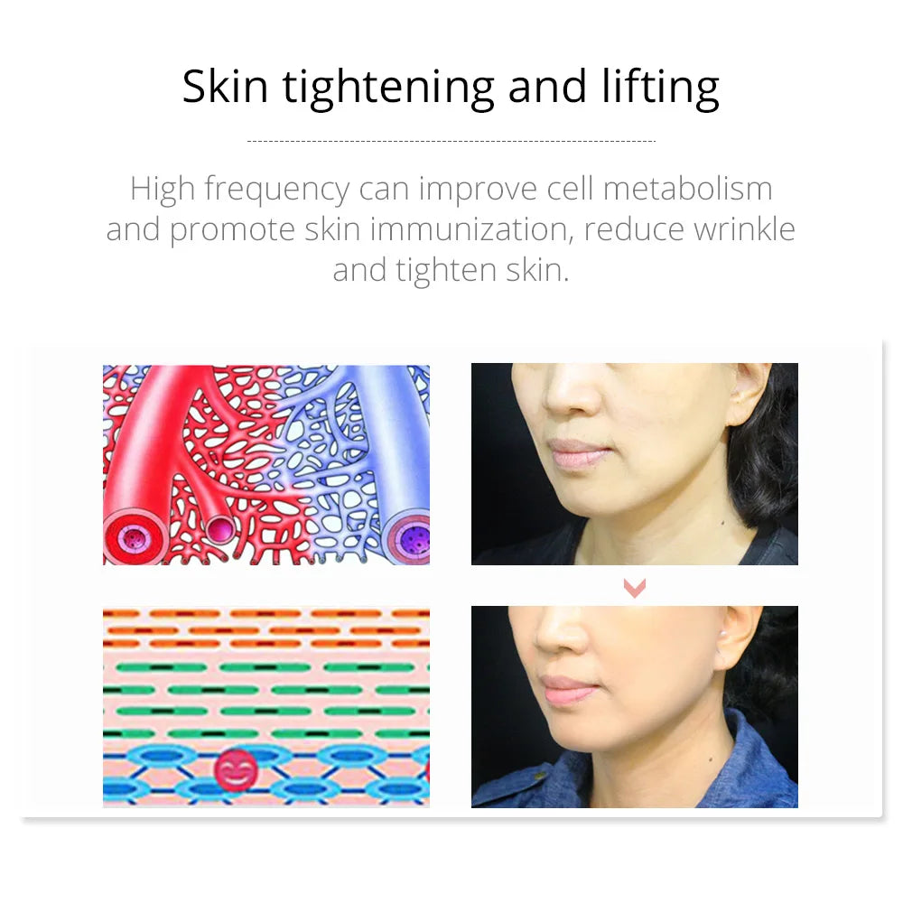High Frequency Facial Therapy Wand
